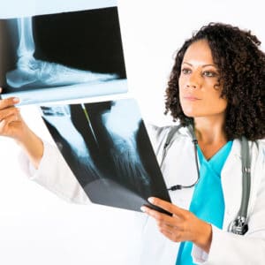 Woman podiatrist in bright blue shirt and white lab coat examines and compares two x-ray images of an injured foot